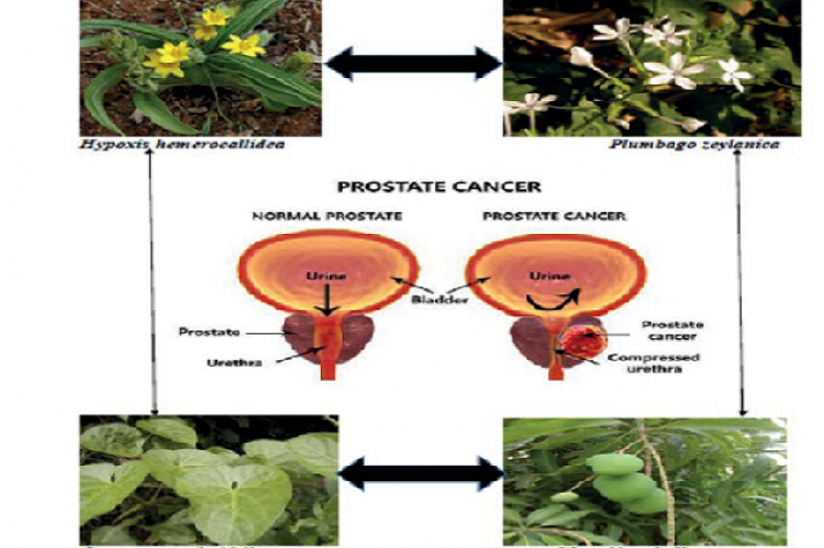 prostate health titanflow
